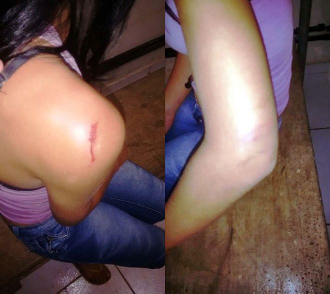Jovem é agredida pelo marido no Jardim das Violetas