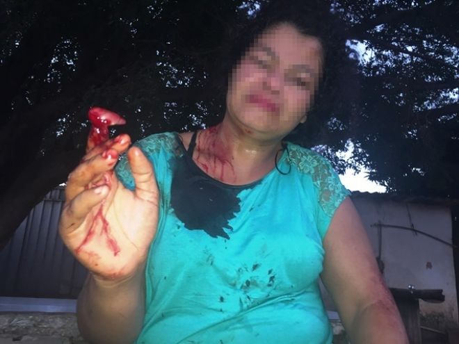 PM registra tentativa de homicídio no bairro Jupía em Três Lagoas