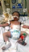 Descaso auxiliadora em parto bebe