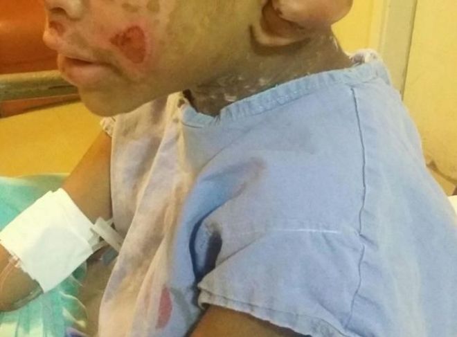 Crian&ccedil;a espancada por tios e que supostamente foi alvo de magia negra passa por cirurgia