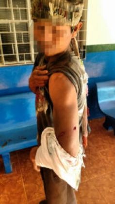 Indígenas são baleados após ataque em município de Caarapó