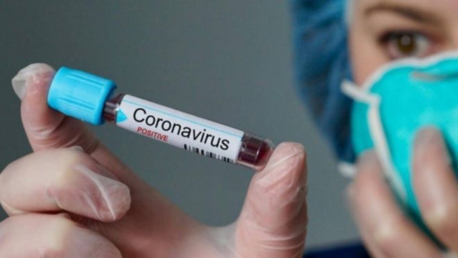 Comissão aprova medida que destina R$ 11,3 milhões para combater ao coronavírus