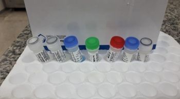 Saúde inicia compra de kits para 10 mil testes do coronavírus