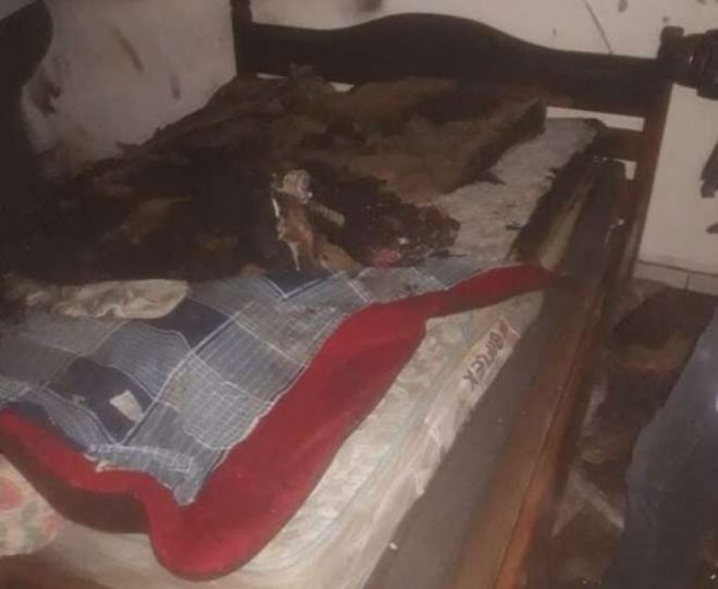 Morre mulher que foi queimada pelo marido