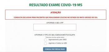 Novo sistema: Mato Grosso do Sul terá agilidade na entrega de exames da covid-19