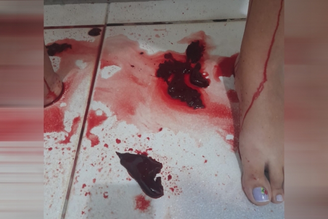 “Eles vão abrir minha filha de novo”, declara mãe após suposta falha em cesariana
