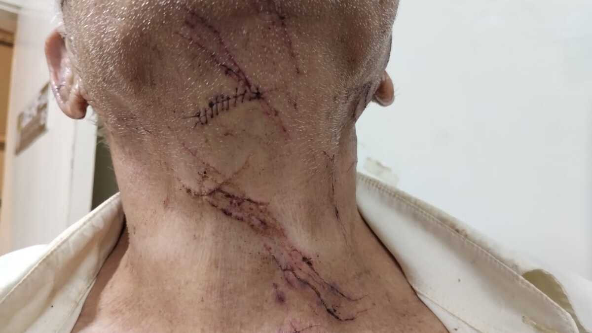Idoso de 76 anos sofre tentativa de latrocínio