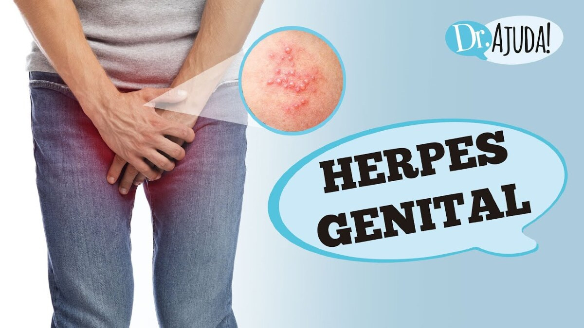 Herpes Genital: O que é? Quais sintomas e tratamentos