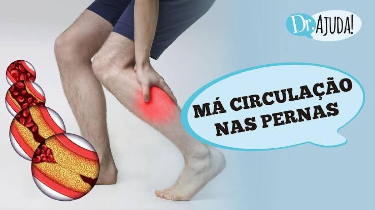 Dr. Ajuda: o que causa dor e má circulação nas pernas?