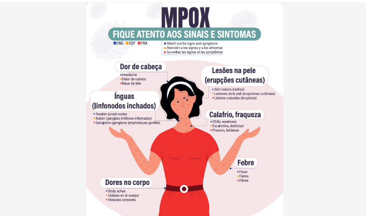 Portos e aeroportos terão de expor materiais informativos sobre mpox