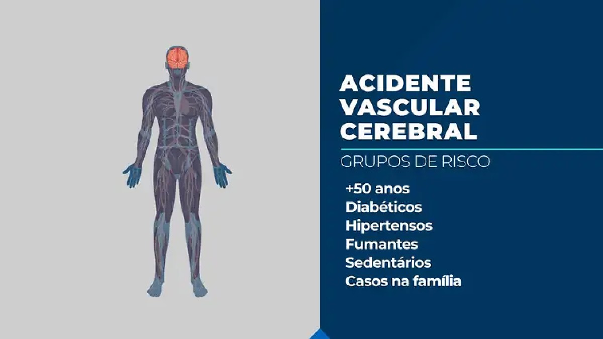 AVC mata uma pessoa a cada seis minutos no Brasil