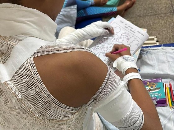 Queimaduras em crian&ccedil;as acendem alerta durante f&eacute;rias em Mato Grosso do Sul