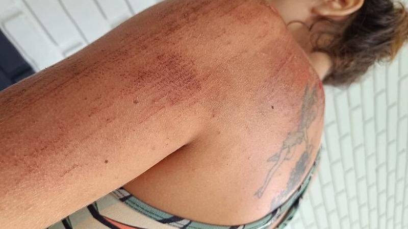 “Ele arrancou com o carro enquanto segurava a criança”, disse vítima